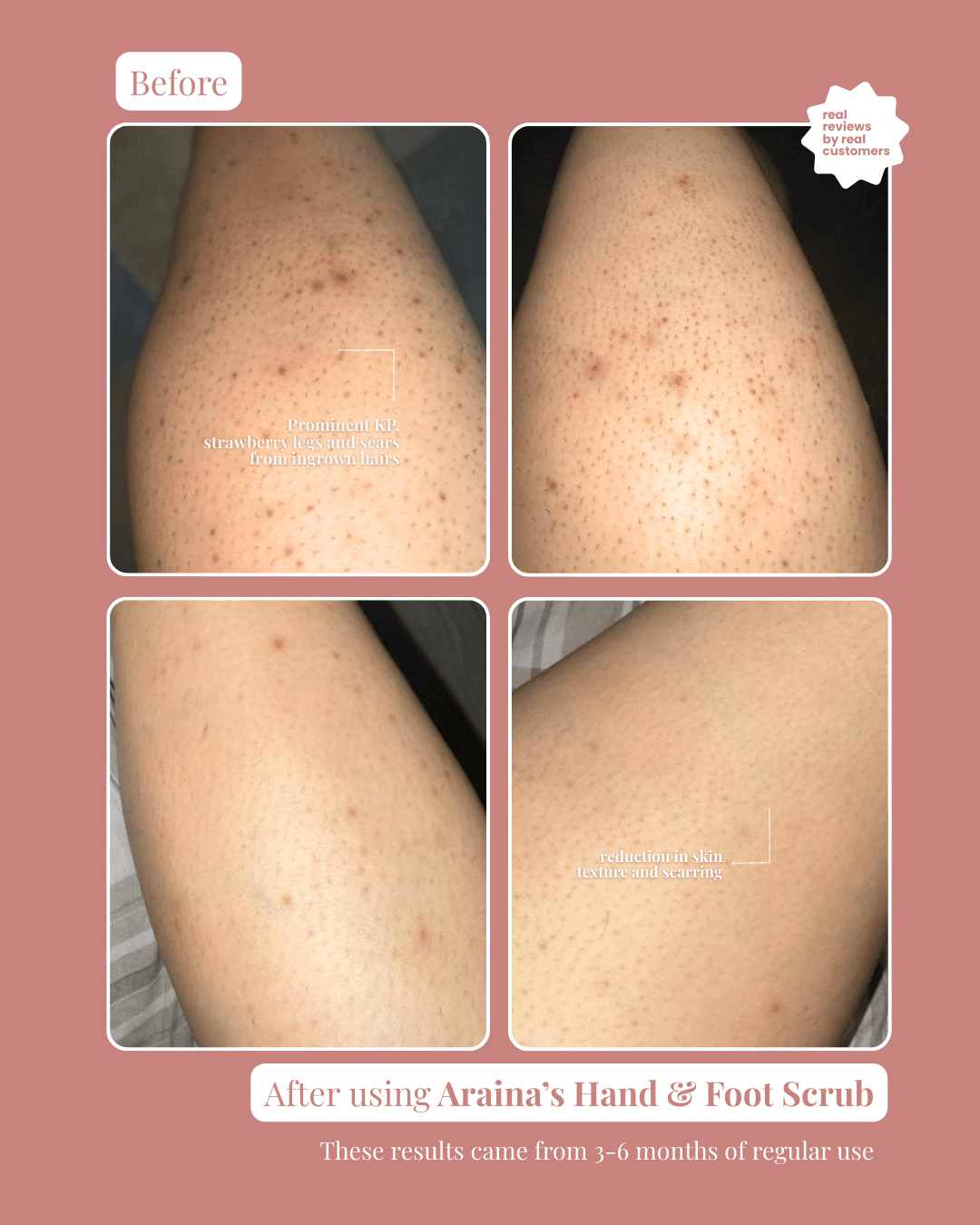 Hand & Foot Scrub