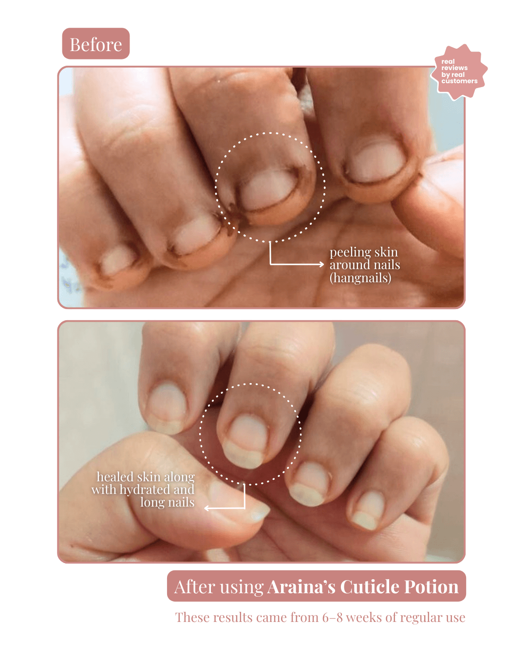 Cuticle Potion