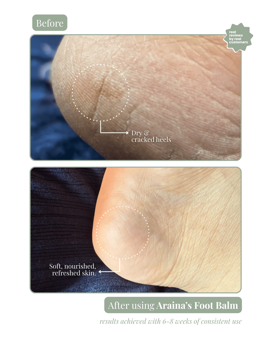 Foot Balm